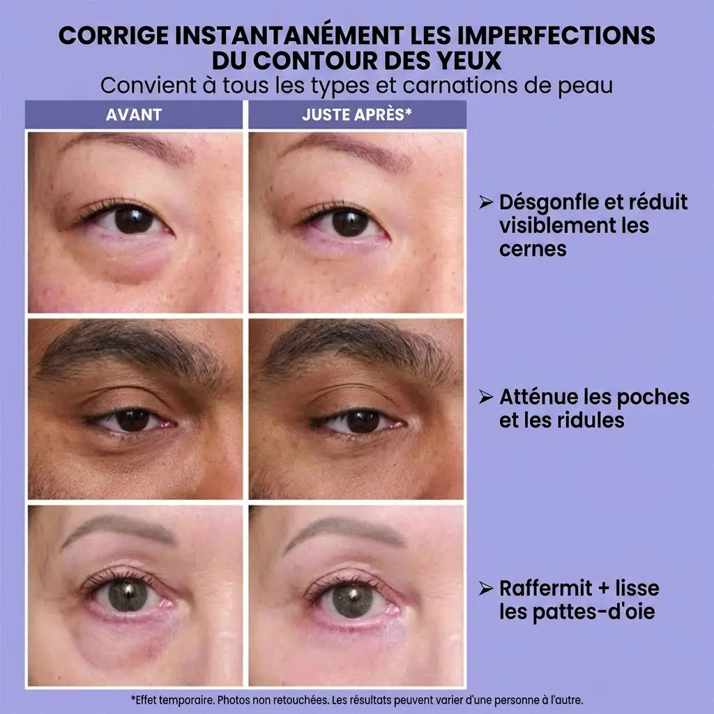 Vaolla Tenseur Regard