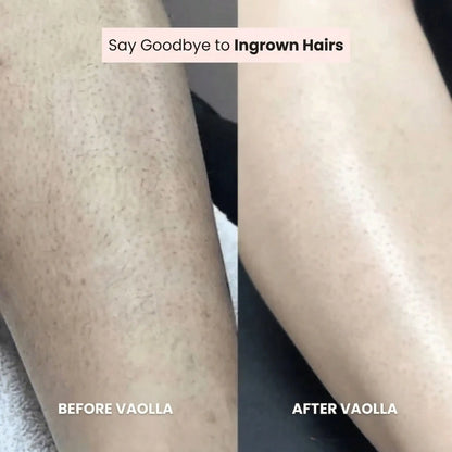 Vaolla® Razor